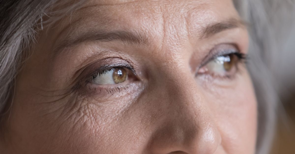 Graves' Disease