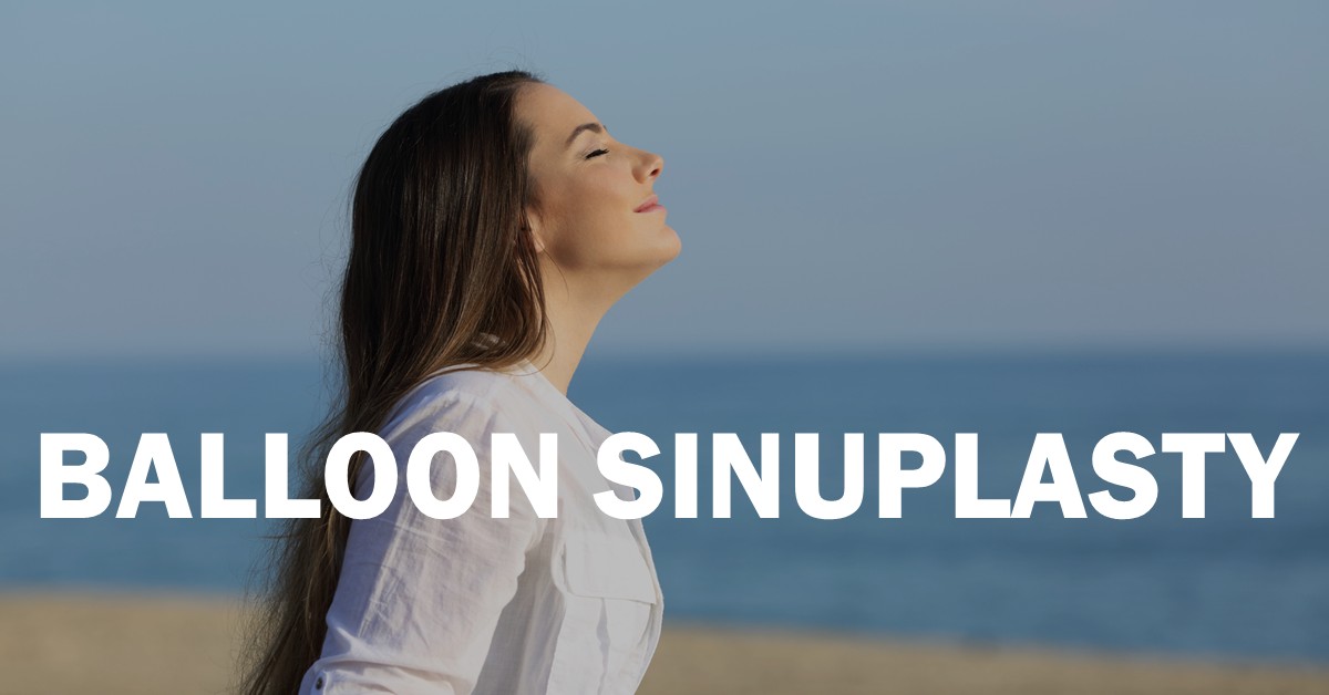 Balloon Sinuplasty Balloon Sinuplasty